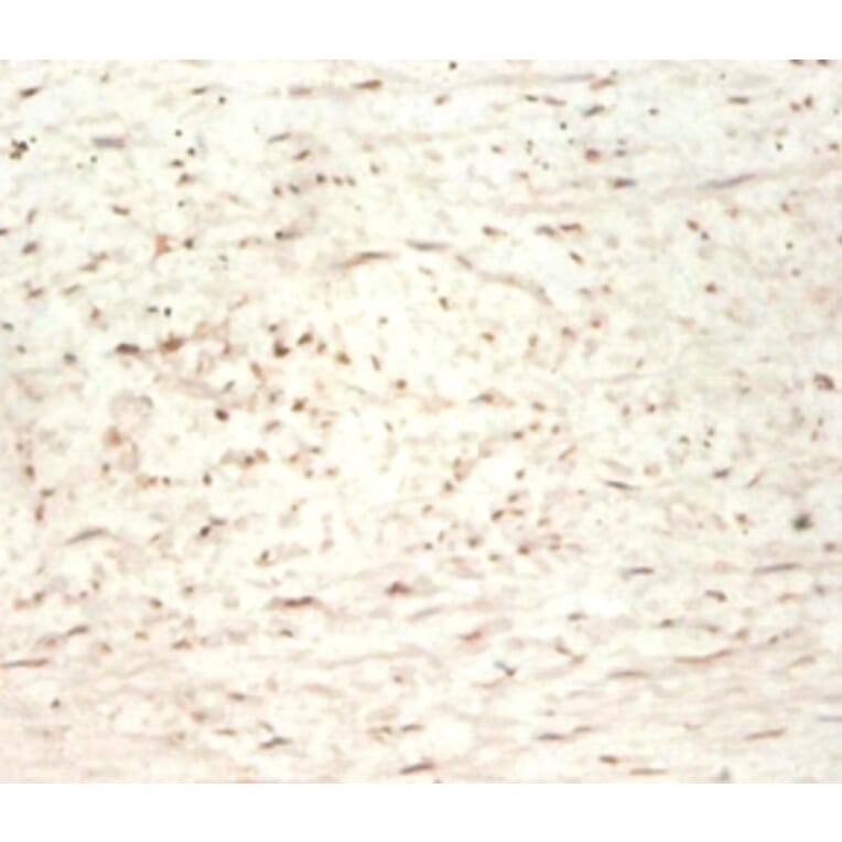 Immunohistochemistry - Transgelin Polyclonal Antibody from Signalway Antibody (42165) - Antibodies.com