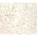 Immunohistochemistry - Transgelin Polyclonal Antibody from Signalway Antibody (42165) - Antibodies.com