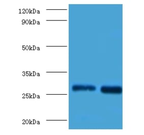 Galectin-3 Polyclonal Antibody from Signalway Antibody (42237) - Antibodies.com