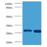 Galectin-3 Polyclonal Antibody from Signalway Antibody (42237) - Antibodies.com