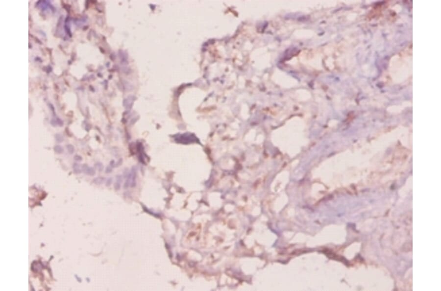 Immunohistochemistry - Galectin-3 Polyclonal Antibody from Signalway Antibody (42237) - Antibodies.com