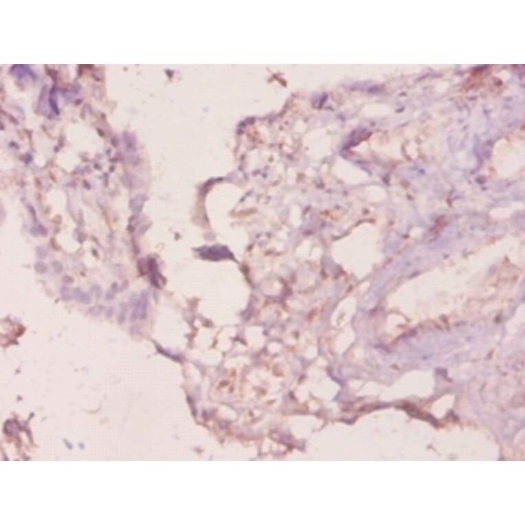 Immunohistochemistry - Galectin-3 Polyclonal Antibody from Signalway Antibody (42237) - Antibodies.com