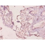 Immunohistochemistry - Galectin-3 Polyclonal Antibody from Signalway Antibody (42237) - Antibodies.com