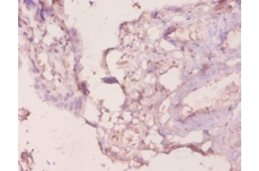 Immunohistochemistry - Galectin-3 Polyclonal Antibody from Signalway Antibody (42237) - Antibodies.com