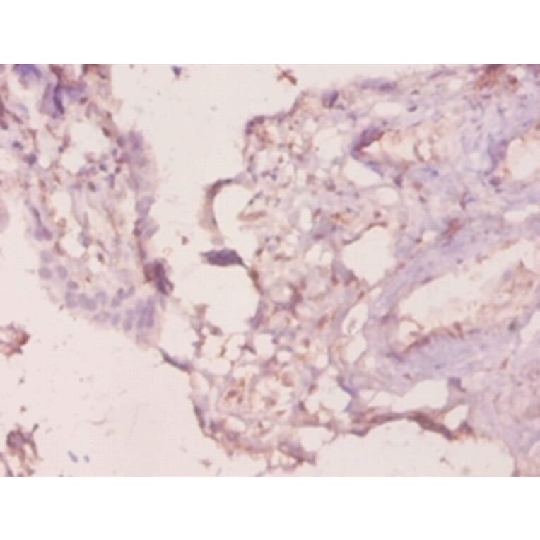 Immunohistochemistry - Galectin-3 Polyclonal Antibody from Signalway Antibody (42237) - Antibodies.com