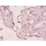 Immunohistochemistry - Galectin-3 Polyclonal Antibody from Signalway Antibody (42237) - Antibodies.com