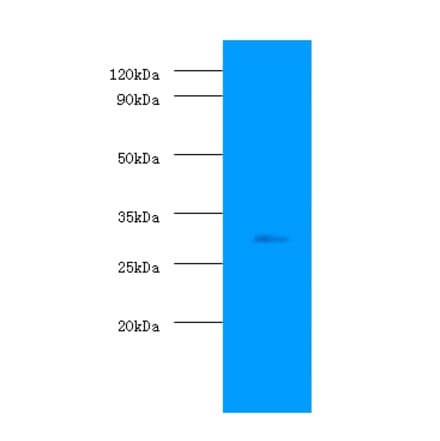 Prohibitin Polyclonal Antibody from Signalway Antibody (42289) - Antibodies.com