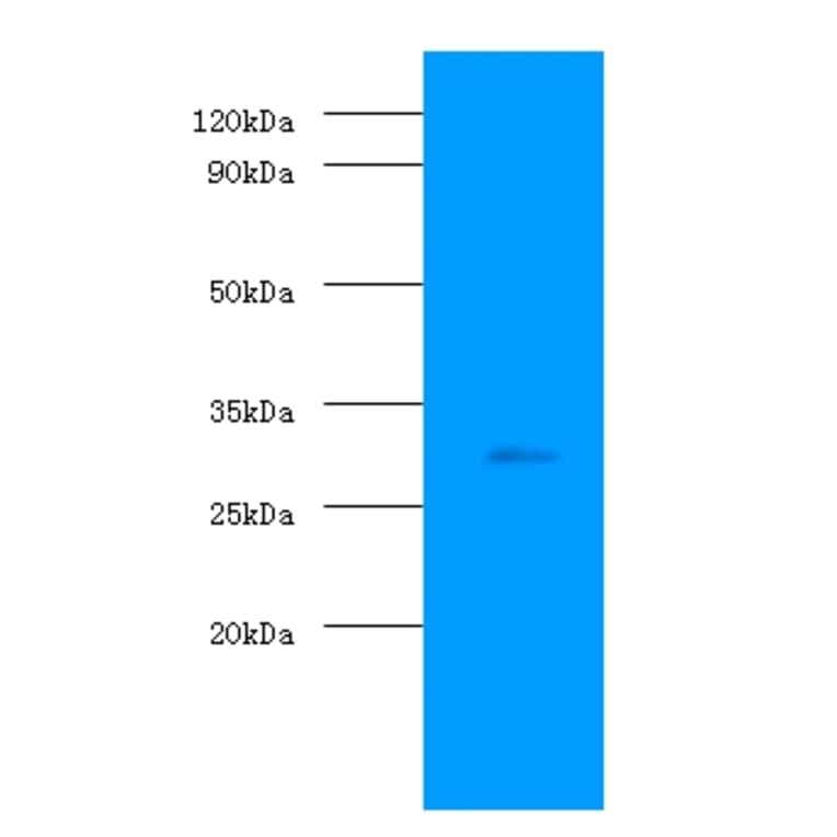 Prohibitin Polyclonal Antibody from Signalway Antibody (42289) - Antibodies.com