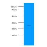 Prohibitin Polyclonal Antibody from Signalway Antibody (42289) - Antibodies.com