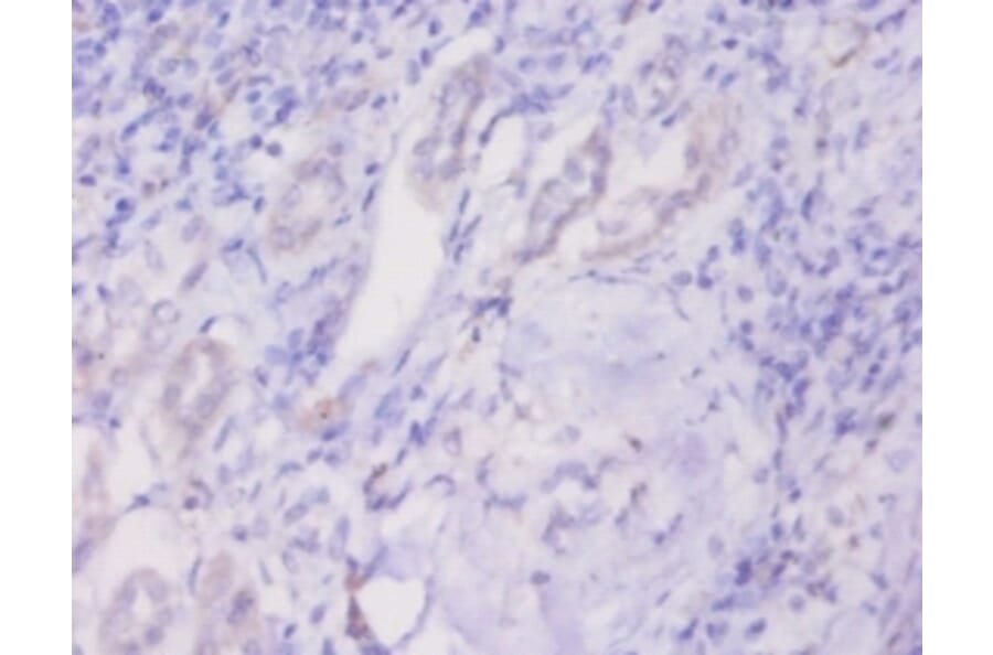 Immunohistochemistry - Prohibitin Polyclonal Antibody from Signalway Antibody (42289) - Antibodies.com