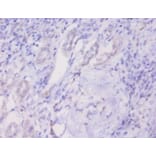 Immunohistochemistry - Prohibitin Polyclonal Antibody from Signalway Antibody (42289) - Antibodies.com