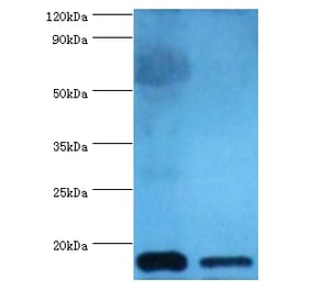 Cystatin-C Polyclonal Antibody from Signalway Antibody (42452) - Antibodies.com