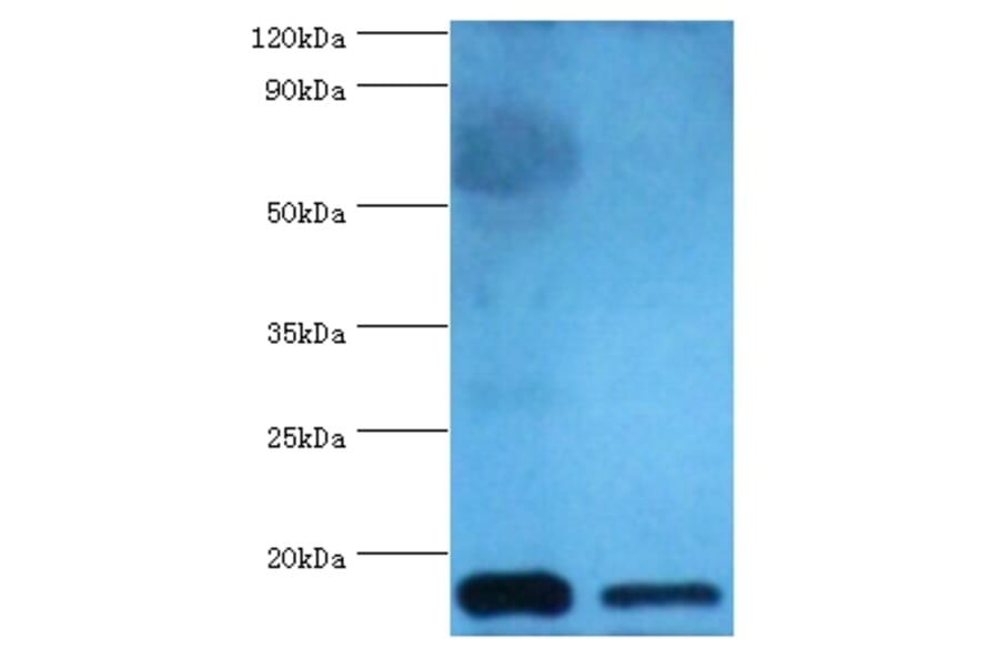 Cystatin-C Polyclonal Antibody from Signalway Antibody (42452) - Antibodies.com