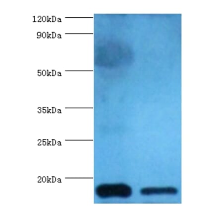Cystatin-C Polyclonal Antibody from Signalway Antibody (42452) - Antibodies.com