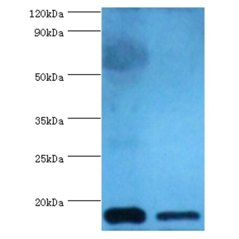 Cystatin-C Polyclonal Antibody from Signalway Antibody (42452) - Antibodies.com