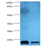 Cystatin-C Polyclonal Antibody from Signalway Antibody (42452) - Antibodies.com