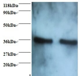 Annexin A5 Polyclonal Antibody from Signalway Antibody (42457) - Antibodies.com