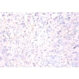 Immunohistochemistry - Annexin A5 Polyclonal Antibody from Signalway Antibody (42457) - Antibodies.com