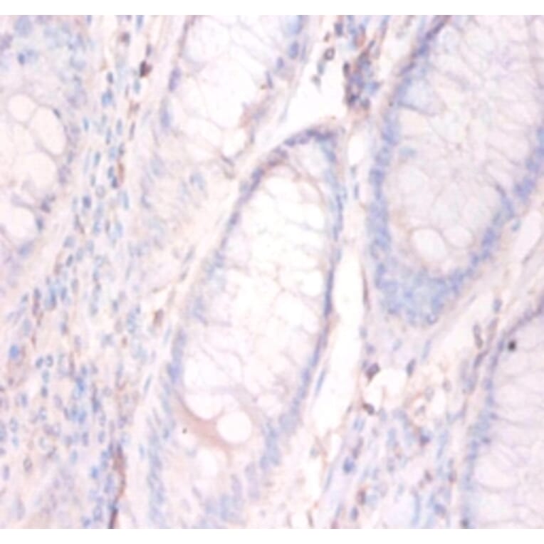 Immunohistochemistry - Annexin A5 Polyclonal Antibody from Signalway Antibody (42457) - Antibodies.com