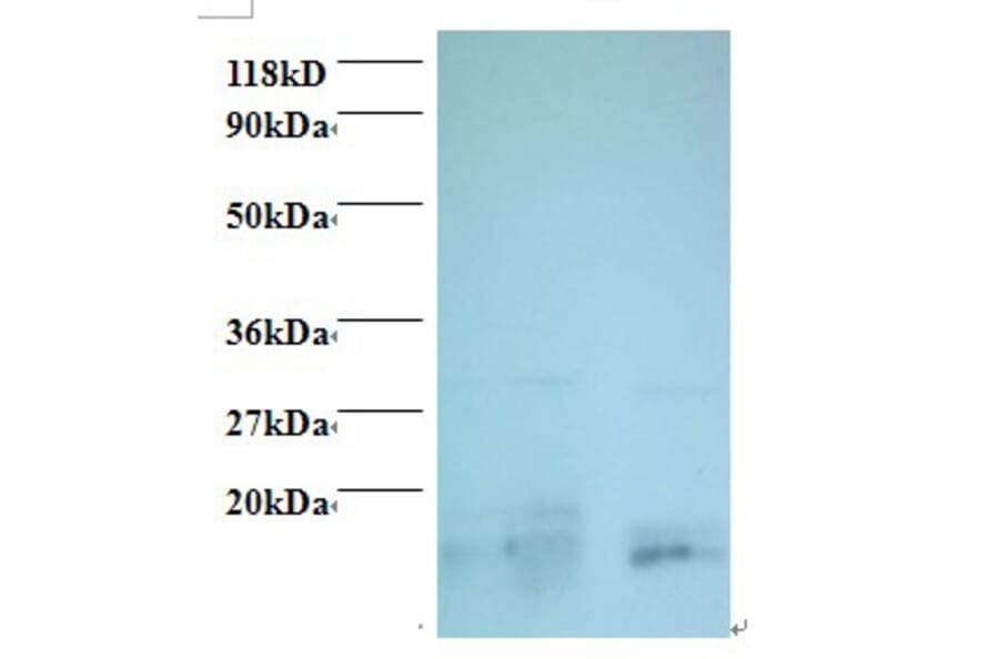 Charged multivesicular body protein 2a Polyclonal Antibody from Signalway Antibody (42415) - Antibodies.com