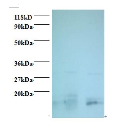 Charged multivesicular body protein 2a Polyclonal Antibody from Signalway Antibody (42415) - Antibodies.com