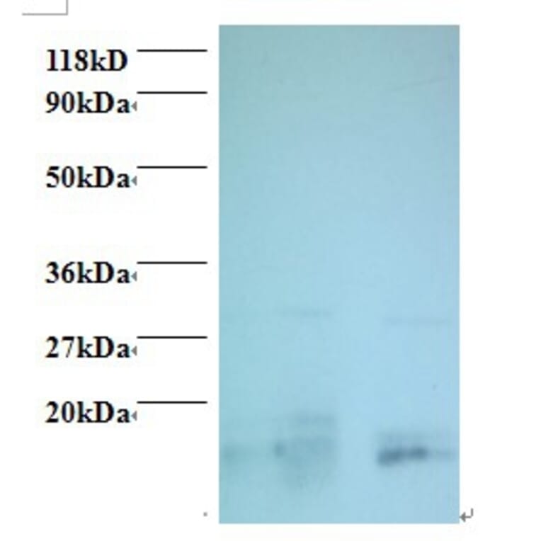 Charged multivesicular body protein 2a Polyclonal Antibody from Signalway Antibody (42415) - Antibodies.com