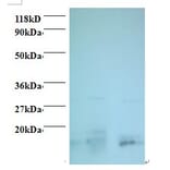 Charged multivesicular body protein 2a Polyclonal Antibody from Signalway Antibody (42415) - Antibodies.com