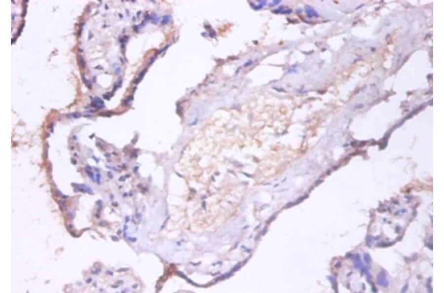Immunohistochemistry - Charged multivesicular body protein 2a Polyclonal Antibody from Signalway Antibody (42415)