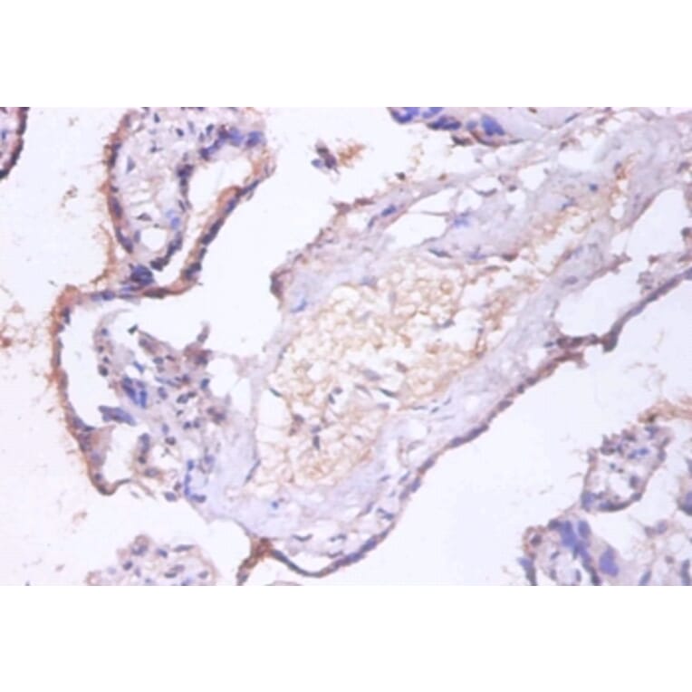 Immunohistochemistry - Charged multivesicular body protein 2a Polyclonal Antibody from Signalway Antibody (42415)