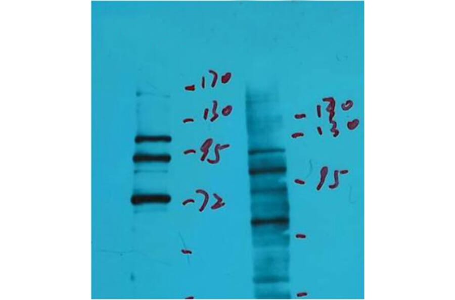 Western blot - Insulin Degrading Enzyme Mouse Monoclonal Antibody from Signalway Antibody (38040) - Antibodies.com