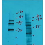 Western blot - Insulin Degrading Enzyme Mouse Monoclonal Antibody from Signalway Antibody (38040) - Antibodies.com