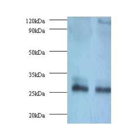 Thiopurine S-methyltransferase Polyclonal Antibody from Signalway Antibody (42134) - Antibodies.com