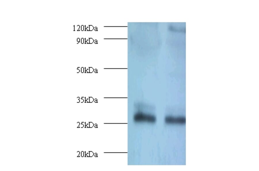 Thiopurine S-methyltransferase Polyclonal Antibody from Signalway Antibody (42134) - Antibodies.com