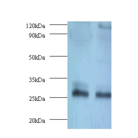 Thiopurine S-methyltransferase Polyclonal Antibody from Signalway Antibody (42134) - Antibodies.com