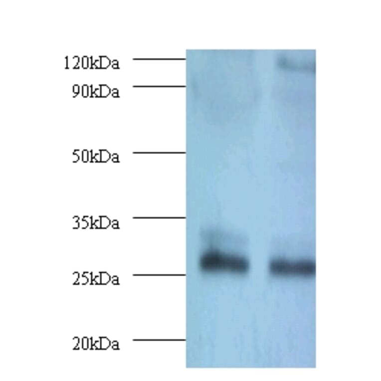 Thiopurine S-methyltransferase Polyclonal Antibody from Signalway Antibody (42134) - Antibodies.com