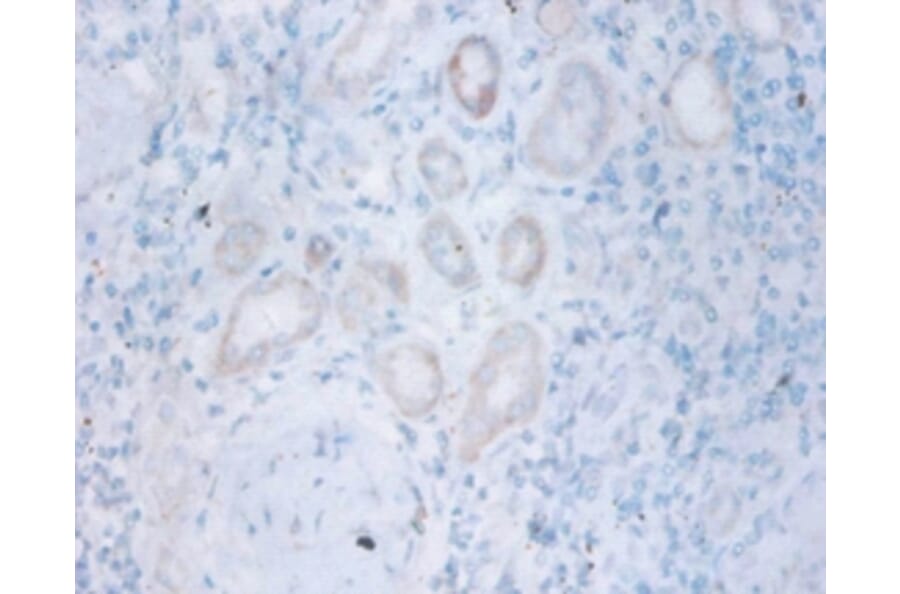 Immunohistochemistry - Thiopurine S-methyltransferase Polyclonal Antibody from Signalway Antibody (42134)