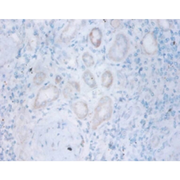 Immunohistochemistry - Thiopurine S-methyltransferase Polyclonal Antibody from Signalway Antibody (42134)