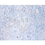 Immunohistochemistry - Thiopurine S-methyltransferase Polyclonal Antibody from Signalway Antibody (42134)