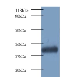 Proteasome subunit beta type-7 Polyclonal Antibody from Signalway Antibody (42249) - Antibodies.com