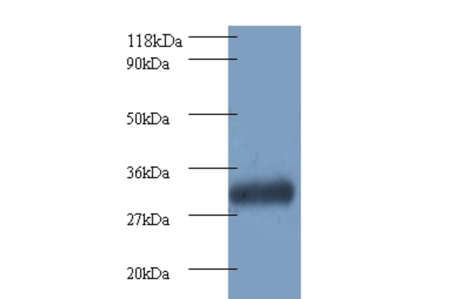 Proteasome subunit beta type-7 Polyclonal Antibody from Signalway Antibody (42249) - Antibodies.com