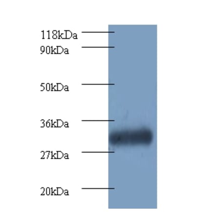 Proteasome subunit beta type-7 Polyclonal Antibody from Signalway Antibody (42249) - Antibodies.com