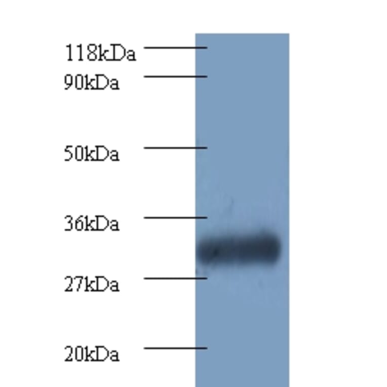Proteasome subunit beta type-7 Polyclonal Antibody from Signalway Antibody (42249) - Antibodies.com