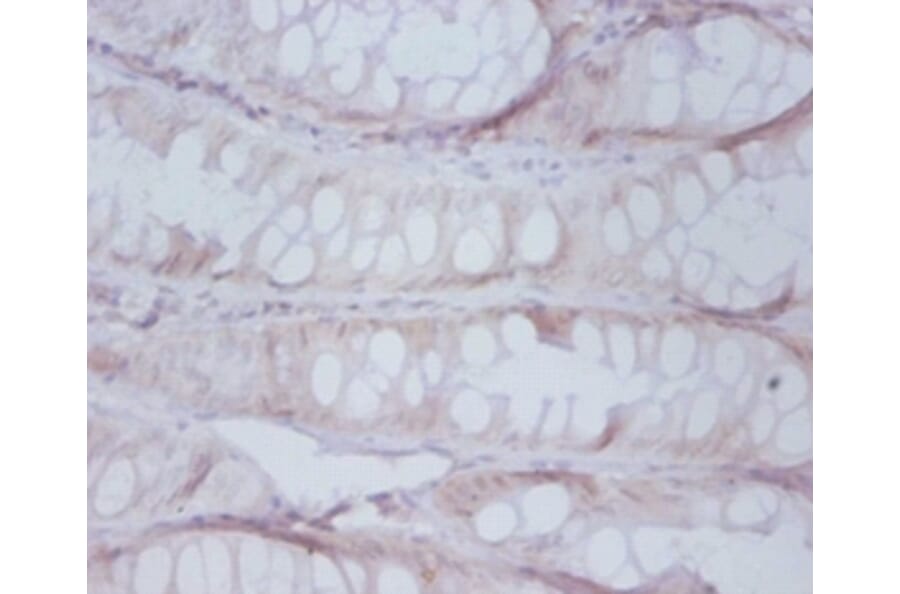 Immunohistochemistry - Proteasome subunit beta type-7 Polyclonal Antibody from Signalway Antibody (42249)