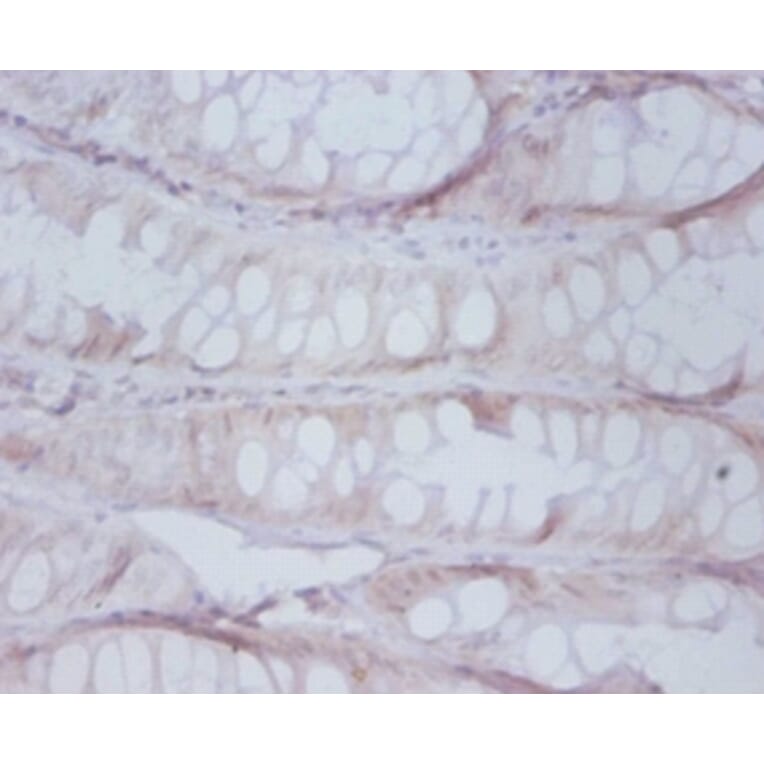 Immunohistochemistry - Proteasome subunit beta type-7 Polyclonal Antibody from Signalway Antibody (42249)
