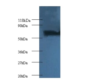 Proteasome subunit beta type-4 Polyclonal Antibody from Signalway Antibody (42251) - Antibodies.com