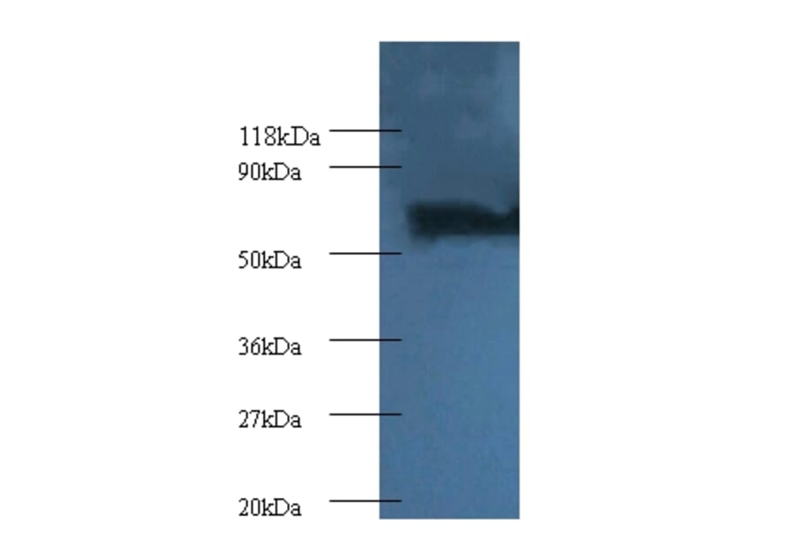 Proteasome subunit beta type-4 Polyclonal Antibody from Signalway Antibody (42251) - Antibodies.com