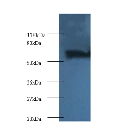 Proteasome subunit beta type-4 Polyclonal Antibody from Signalway Antibody (42251) - Antibodies.com