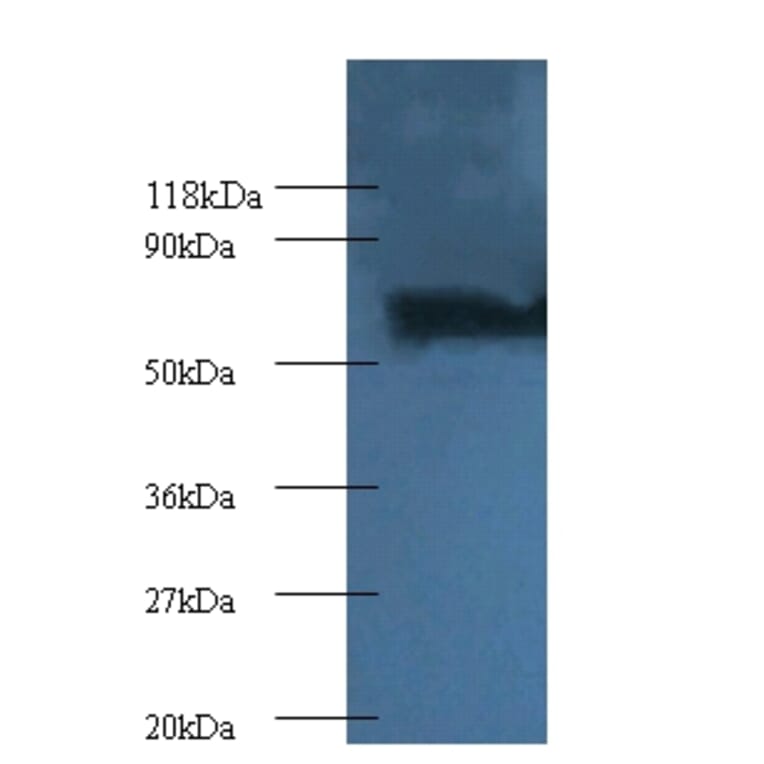 Proteasome subunit beta type-4 Polyclonal Antibody from Signalway Antibody (42251) - Antibodies.com