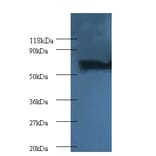 Proteasome subunit beta type-4 Polyclonal Antibody from Signalway Antibody (42251) - Antibodies.com