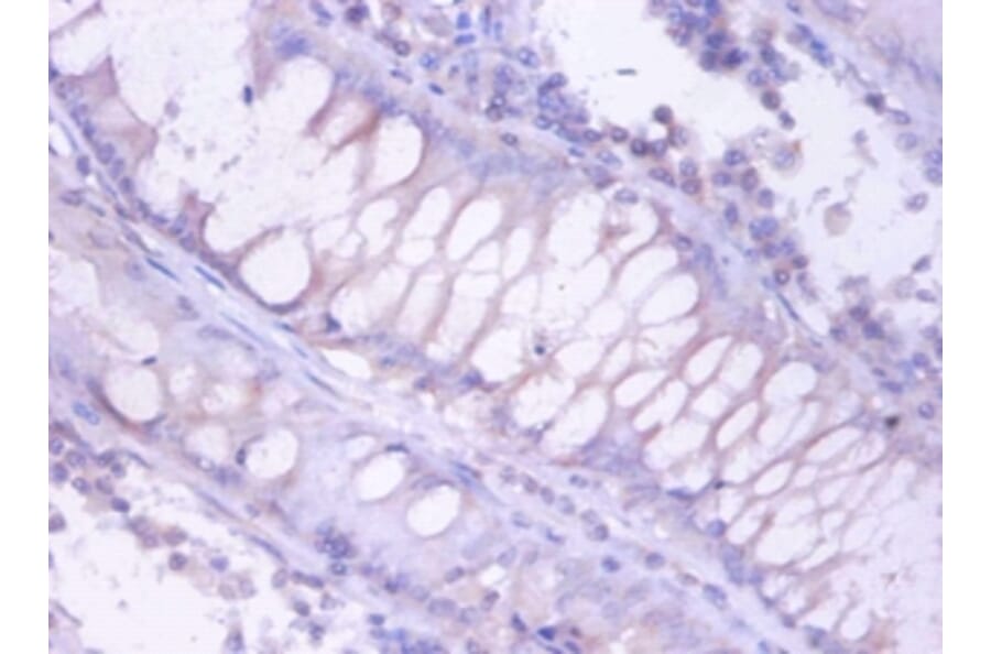 Immunohistochemistry - Proteasome subunit beta type-4 Polyclonal Antibody from Signalway Antibody (42251)
